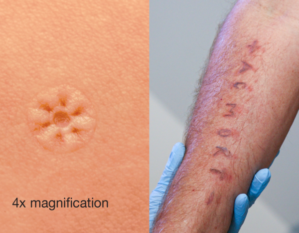 Ld unitest pc wheal reactions 1800x1200